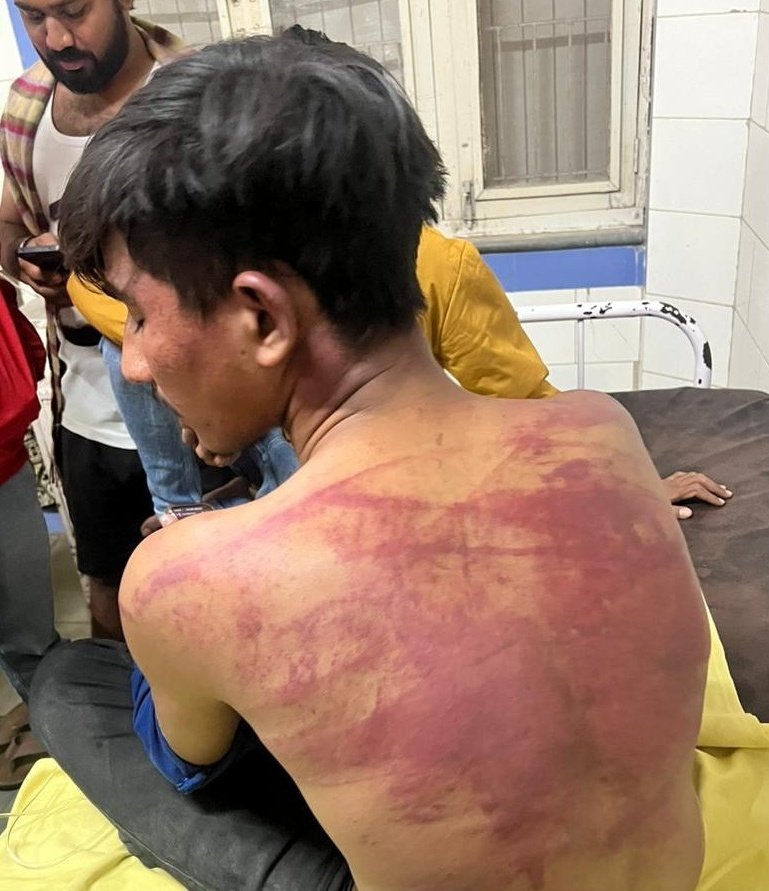 जिस विभूति पटेल ने हाल ही में गुजरात के दलित युवक को जूता चटवाया, वह भाजपा की कार्यकर्ता हैं। 

दलितों के वोट लेने होंगे तब भाजपा वाले उनके पैर धोने चले जायेंगे लेकिन बाकी के दिनों में अपना जूता चटवाएंगे, यही उनका असली मनुवादी चरित्र है!