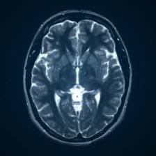 Excited to share a milestone in my AI-driven MRI Image generation project! Completed meticulous data cleaning, and now gearing up to delve into the Gan algorithm. 🚀 #AI #MedicalImaging #InnovationInProgress