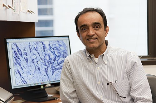 We are deeply saddened by the passing of our @NCIResearchCtr colleague, #pancreaticCancer researcher and friend Perwez Hussain. He was kind. He was brave. He will be missed . tinyurl.com/2f36xtjb