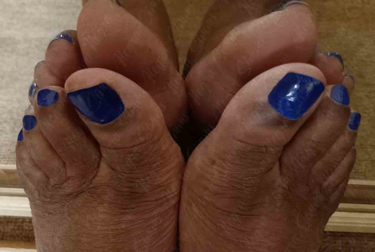 Miladyalegra's tweet image. "✨💙 My toes are a stunning reflection of beauty, fanned out and flawlessly painted in metallic blue. They eagerly await your custom content request! #ToeGoals #MetallicVibes 🌟💅"