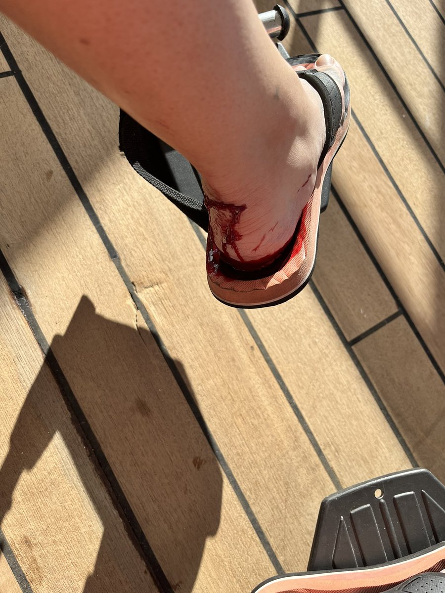 shannanigansj3's tweet photo. @CarnivalCruise I see your customer service is as good as the response from your staff when I got hurt.  Nothing.  Video will show your staff never even got up to assist despite be visibly struggling to walk &amp; blood pooling into my shoe.  I wasn’t even offered a seat until I asked. Disgusting. https://t.co/cWewnjMvuZ