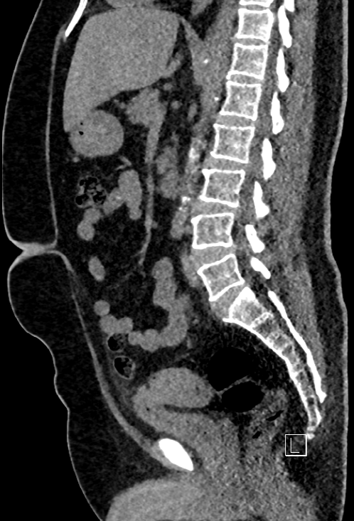 Rad_Bits's tweet photo. Quiz245: Tough case 💪, thoughts?

A randomly selected winner will get a prize 🏆 🎁 
#meded #raded #radiology #mededucation #foamrad #foamed #radres