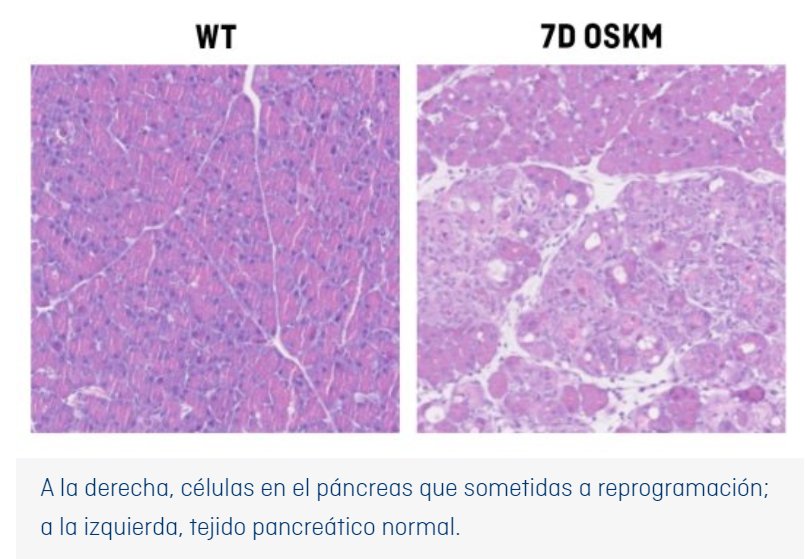 marialosan8's tweet photo. Esta vitamina es un micronutriente esencial en procesos nerviosos, en la síntesis de ADN, etc.

Un equipo de investigación del IRB de Barcelona, revela que esta vitamina tiene un papel crucial en la reprogramación celular y regeneración de los tejidos.

https://t.co/qYz7eqpfKf https://t.co/oVrUYy89HB
