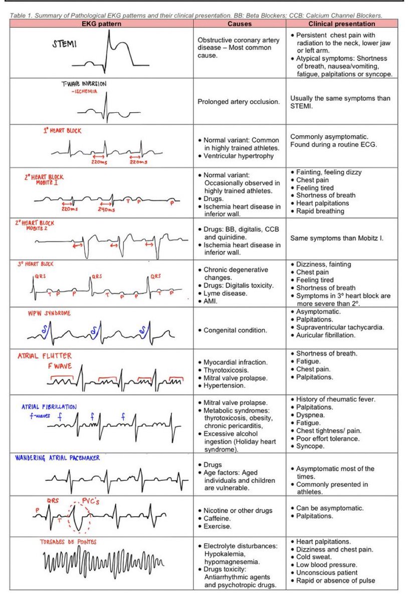 Patología y patrones en el EKG ❤️