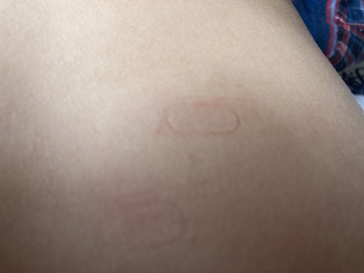 ‼️The abnormality‼️