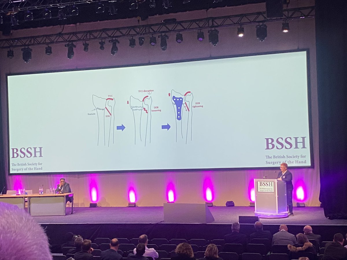 s2dnia's tweet photo. Lots of good points about #DistalRadiusFractures and subsequent #DRUJinstability discussed on #BSSHAutumn2023 in Glasgow this week. Thank you Prof Grey Giddins, Dougie Russel and @jmceachan for your thought provoking lectures. https://t.co/F9Nc1nRRw6