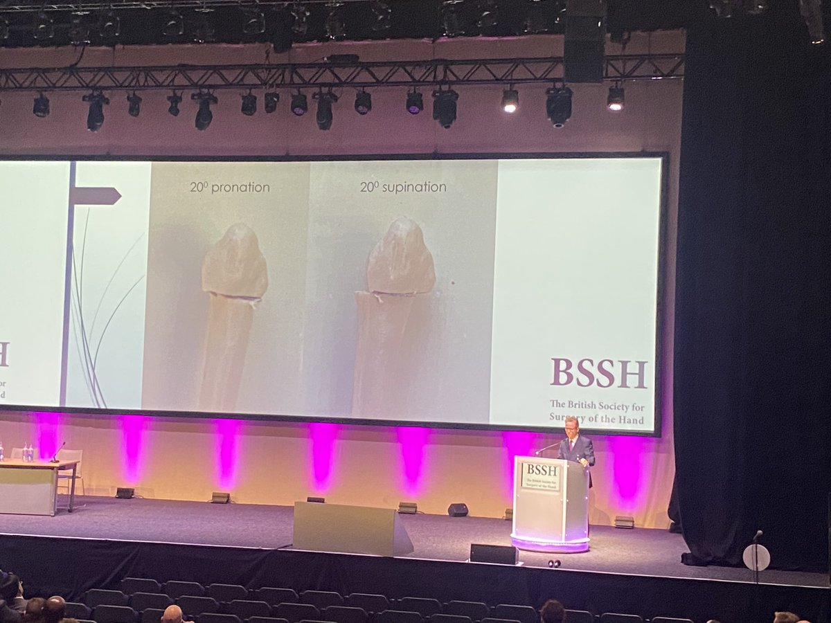 s2dnia's tweet photo. Lots of good points about #DistalRadiusFractures and subsequent #DRUJinstability discussed on #BSSHAutumn2023 in Glasgow this week. Thank you Prof Grey Giddins, Dougie Russel and @jmceachan for your thought provoking lectures. https://t.co/F9Nc1nRRw6