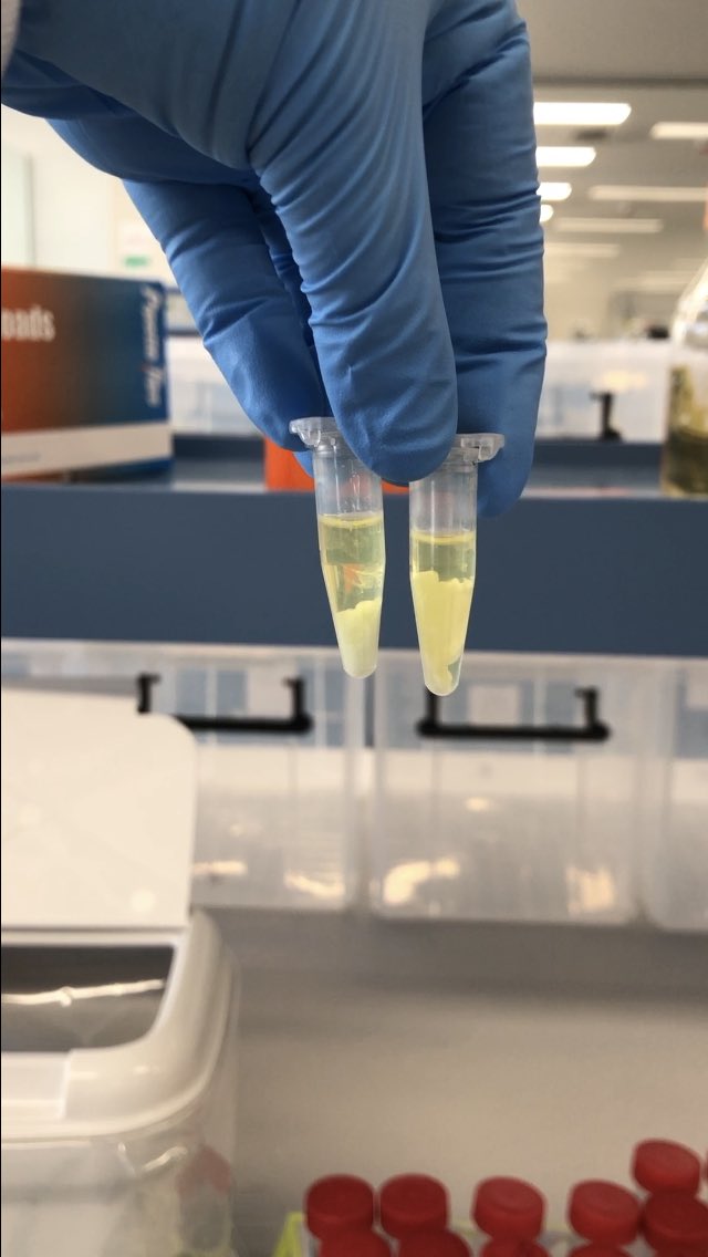 mqsynbioteam's tweet photo. Setting up #plasmids for #PCR 🧬 Stay tuned for the results
🤞
#plswork #PCR #STEM #ausynbiochallenge https://t.co/kSdu4Nba2u
