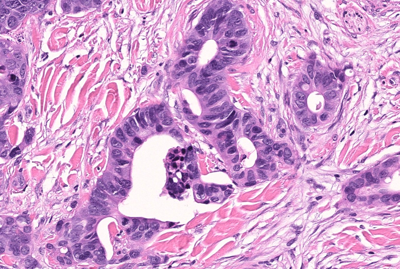 Christine J. Ko, MD on Twitter: