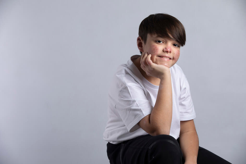 ICS Girona tweet media