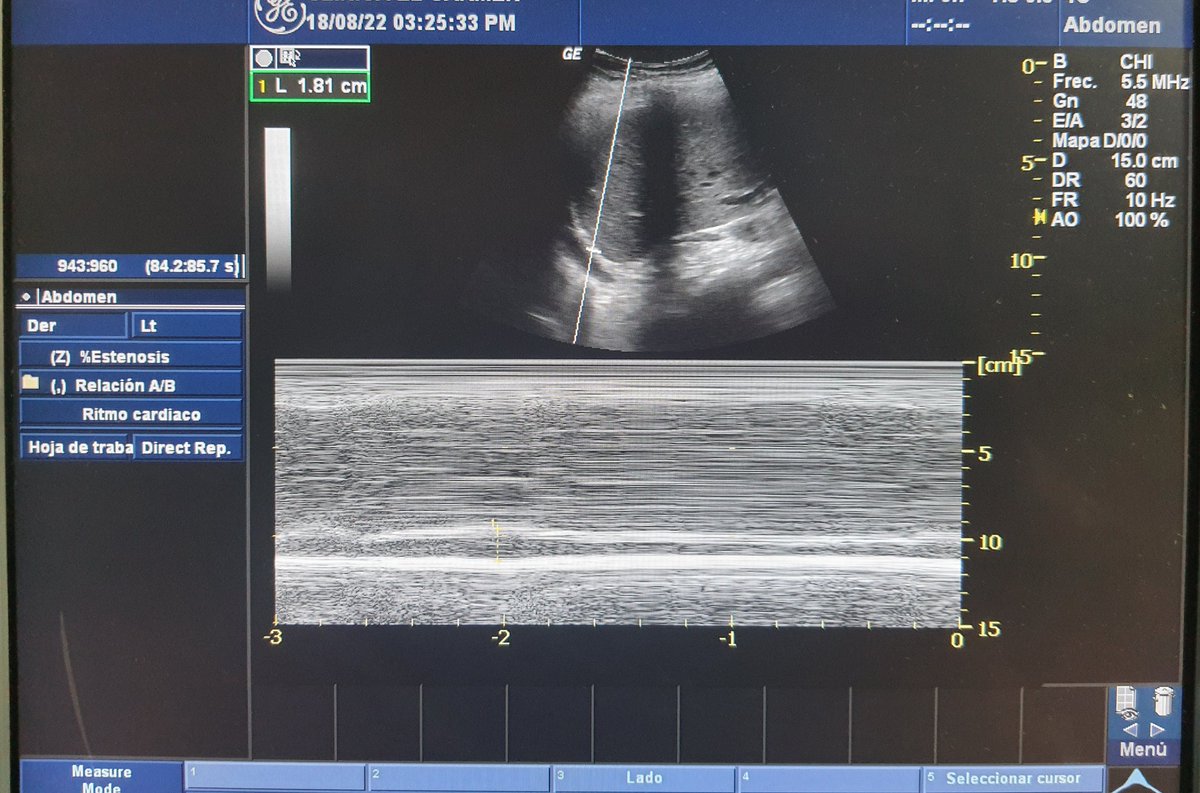 Manuel Arroyo, MD tweet media