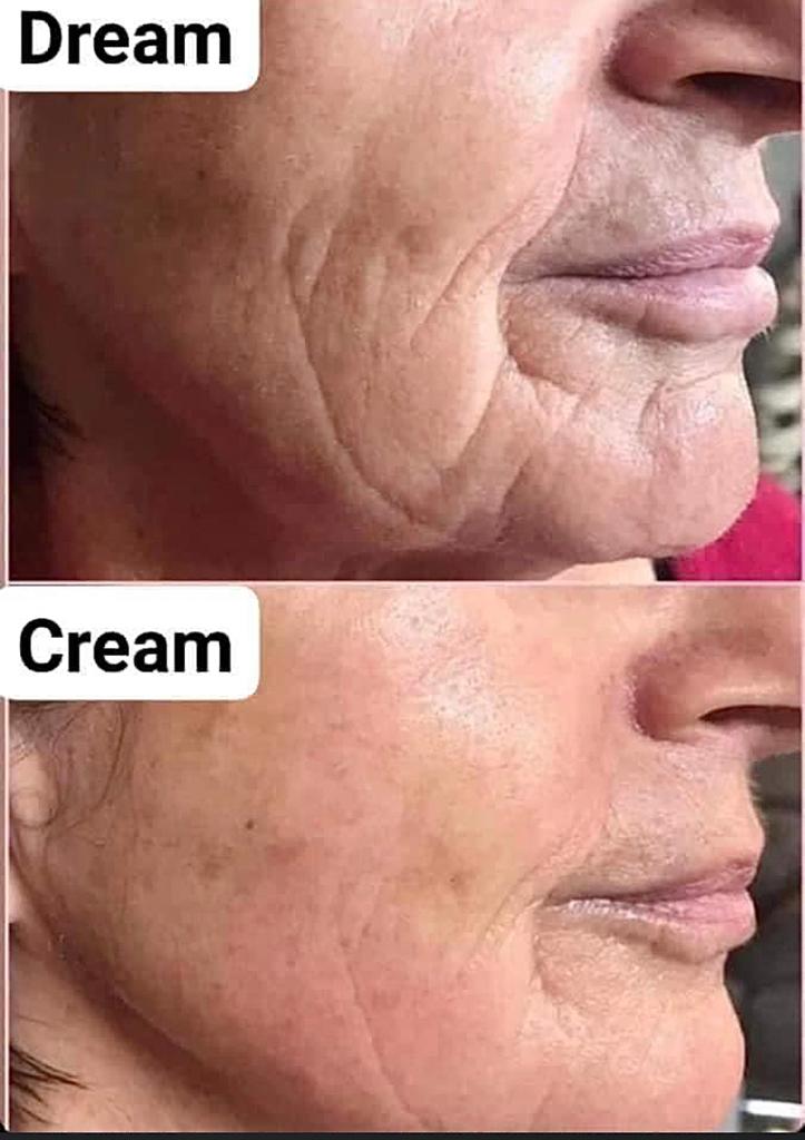 NSMariaGracia's tweet photo. Con ingredientes únicos ageLOC y Tru Face FirmPlex para ayudar a que la piel se vea y se sienta más firme y contorneada.
#antiaging #skintreatment #skincare #skinrejuvenation #rejuvenecer #rejuvenecimiento #antiarrugas #antiwrinkle #reductor https://t.co/P46Nm1ziF4