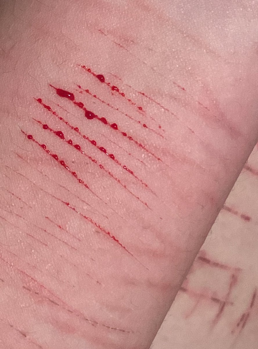 Estoy demasiado cansado, ya ni me puedo mis ojos, quiero solo llorar, no me siento de ánimos y mis amigos me tratan como el pico.