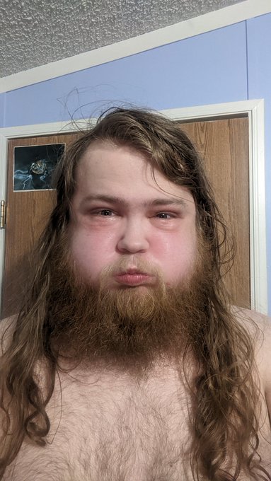 So, this one is really, really weird. Experimental. I inflated my cheeks with N2O, and by extension,<a href="/tag/inflation"class="tags"><span>#inflation</span></a>