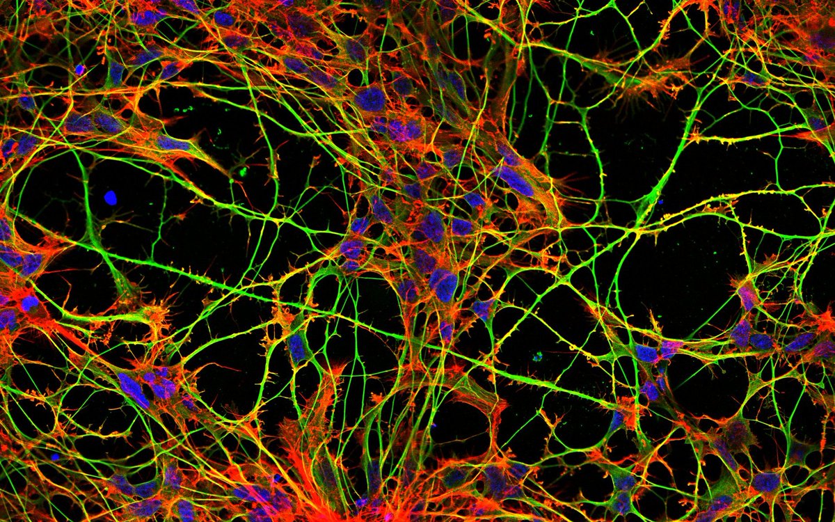 Faculty of Science of Charles University (@science_charles) on Twitter photo The tau protein is an important factor linked to the development of neurodegenerative diseases. The recent discoveries come from the work of an international team (Siahaan et al) including co-authors from our faculty Lenka Libusova and Tereza Humhalova. <a href="/nchembio/">Nature Chemical Biology</a> <a href="/BIOCEV_science/">BIOCEV_SCIENCE</a> The tau protein is an important factor linked to the development of neurodegenerative diseases. The recent discoveries come from the work of an international team (Siahaan et al) including co-authors from our faculty Lenka Libusova and Tereza Humhalova. <a href="/nchembio/">Nature Chemical Biology</a> <a href="/BIOCEV_science/">BIOCEV_SCIENCE</a>