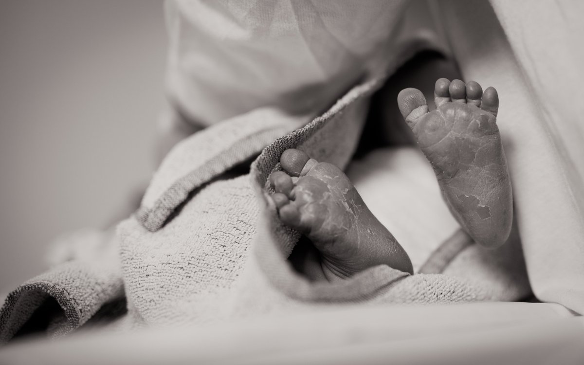 Rana Islamiah Zahroh &amp; colleagues explore factors influencing use of interventions for management of preterm birth.<a href="/meghanbohren/">meghan bohren</a> <a href="/ranazahroh/">Rana Islamiah Zahroh</a> <a href="/oladapo_olufemi/">Femi Oladapo</a> @josh_vogel <a href="/HRPresearch/">HRP</a> <a href="/WHO/">World Health Organization (WHO)</a> <a href="/unimelbMSPGH/">Melbourne School of Population and Global Health</a> <a href="/ahazfiarini/">Alya Hazfiarini</a> <a href="/katherineeeddy/">Katherine Elise Eddy</a> <a href="/otuncalp/">Özge Tunçalp</a> <a href="/UniMelbMDHS/">UniMelb MDHS</a>, doi.org/10.1371/journa…