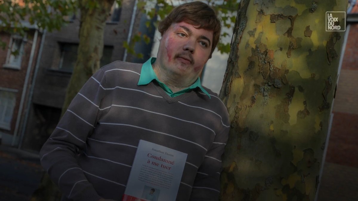 La_Taurauxtv's tweet photo. En 2011,après six années de harcèlement à l’école, Jonathan Destin alors âgé de 16 ans, tentait de mettre fin à ses jours en s’immolant. Il survit mais est brûlé à 72 %. S’en suivront deux mois et demi dans le coma, vingt-trois opérations et une hospitalisation de trois ans. 2/2 https://t.co/xfhuAfTPn6