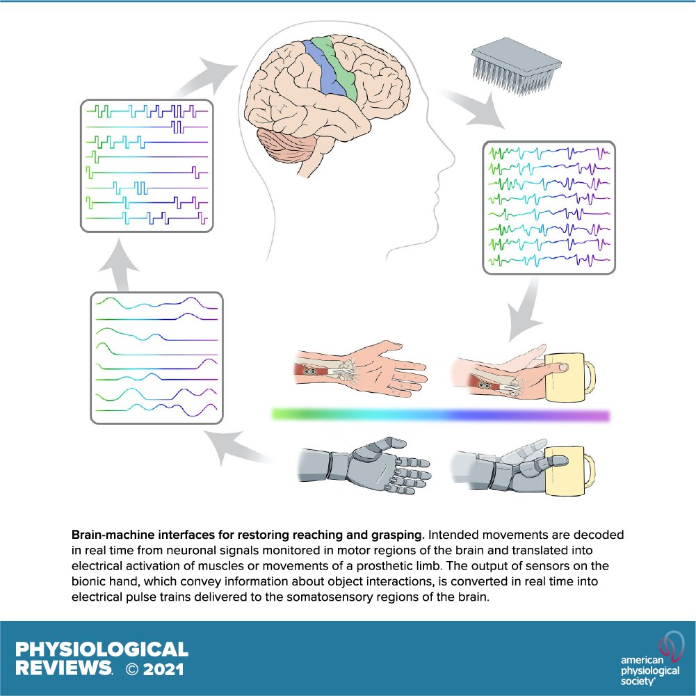 physiolrev's tweet photo. Dr. Chethan Pandarinath of @CoulterBME and @slimanjbensmaia discuss the science and engineering behind sensitized brain-controlled bionic hands:
https://t.co/87ggVOuSrR
#artificialtouch #motorcontrol #neuroprosthetics https://t.co/ZUWe36ds8R