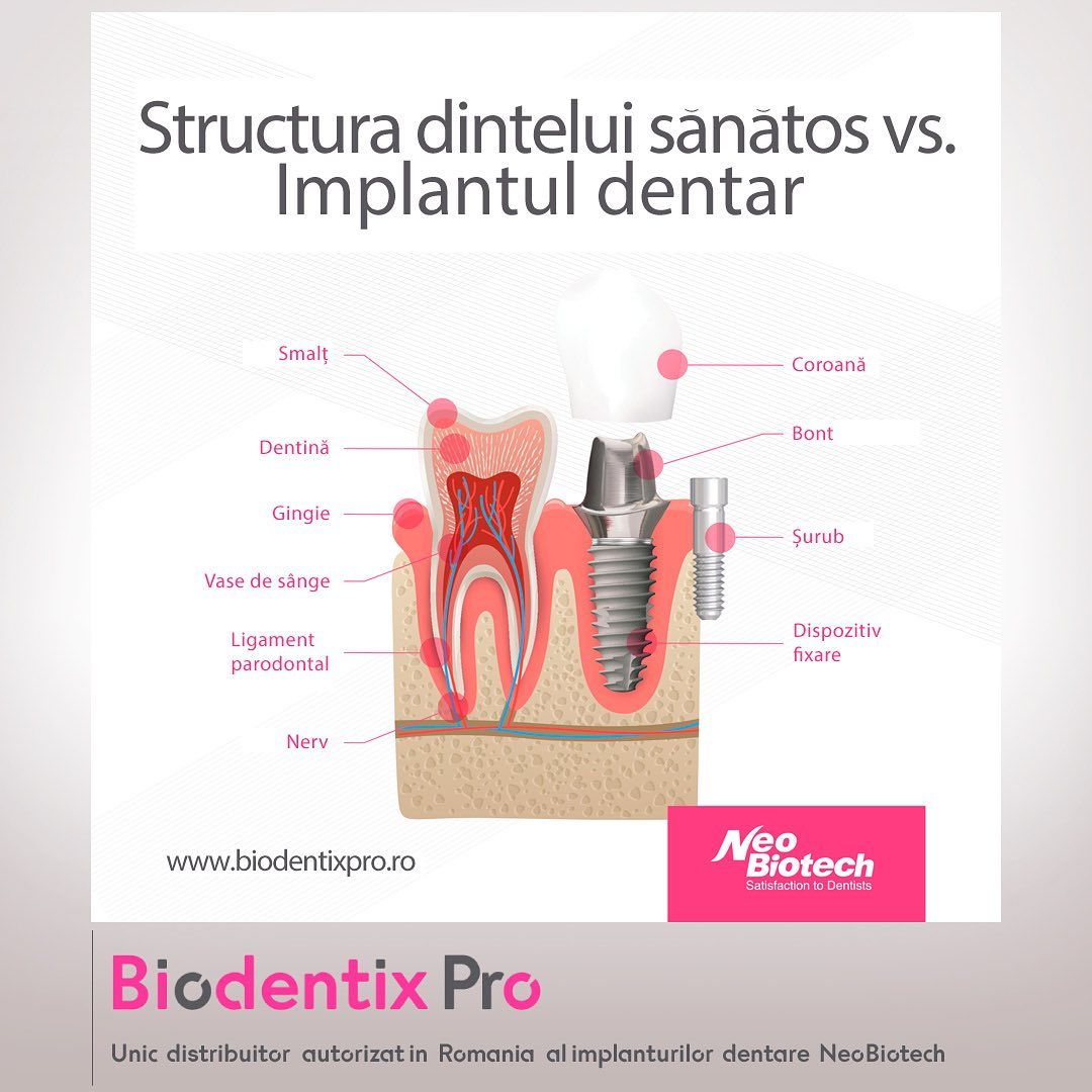 ContinutC's tweet photo. Care este diferenta dintre un #dinte sanatos si un #implant dentar? Hai sa vedem impreuna! 👉
https://t.co/yNQzdKqBeS https://t.co/jDx9acAXLE