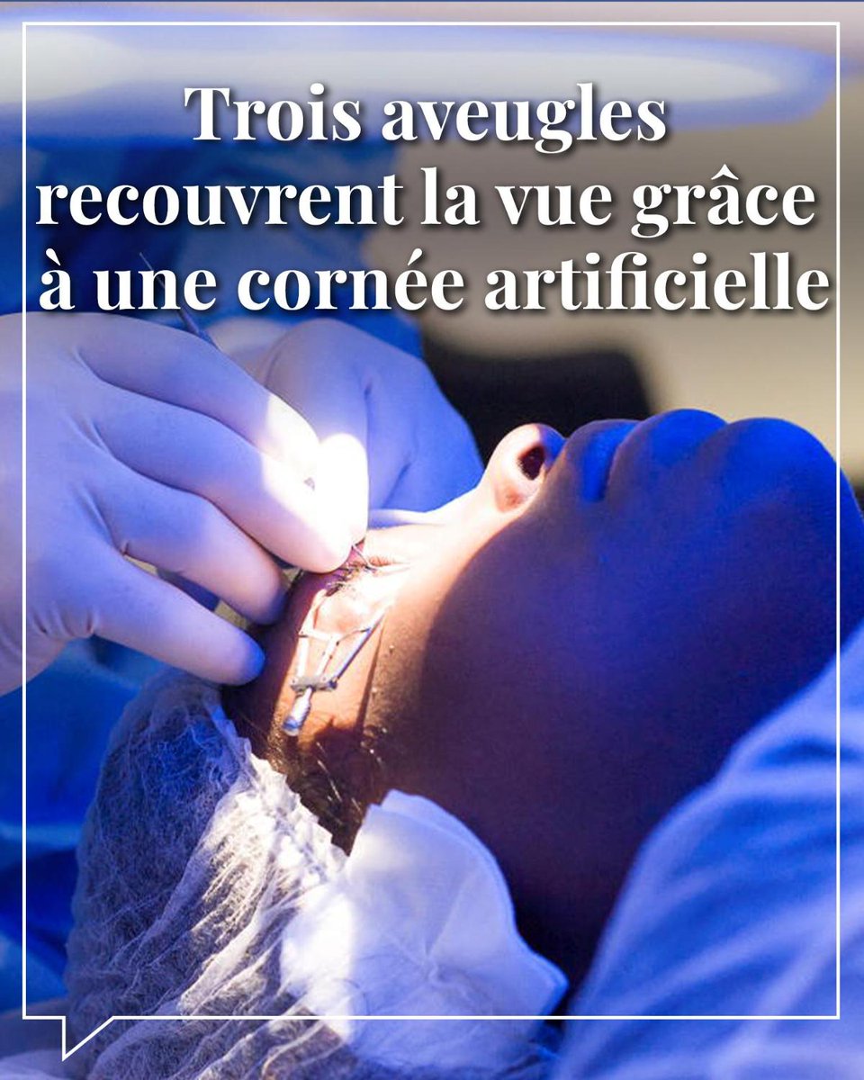 LePoint's tweet photo. Les chercheurs suédois et iraniens qui ont collaboré sur ce projet ont conçu ces cornées artificielles à partir de cellules de peau de cochon. https://t.co/SLGsaJjZLQ https://t.co/qryAiebmky