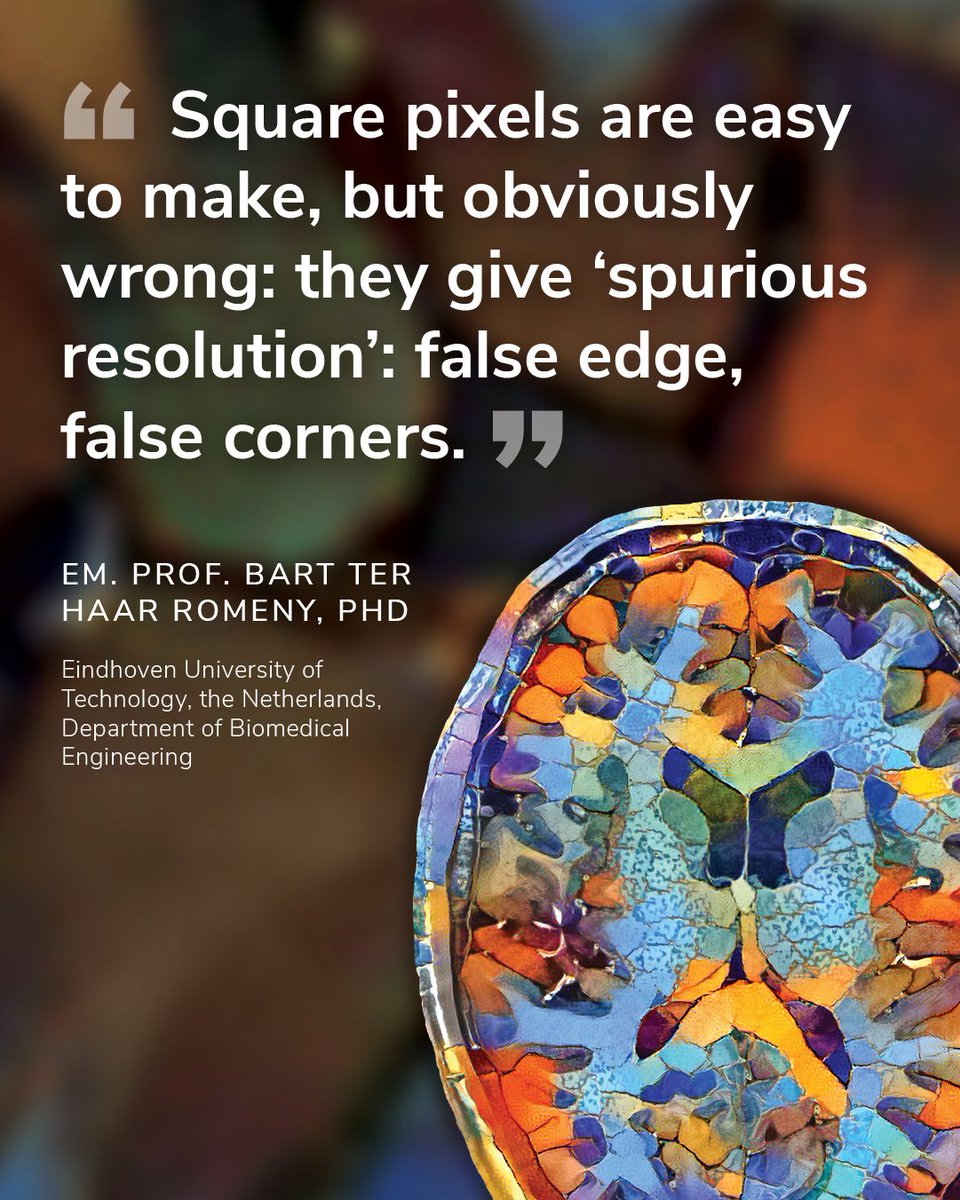 QMENTA_Inc's tweet photo. "Square pixels are easy to make, but obviously wrong: they give spurious resolution: false edge, false corners" #MedicalImaging #ImagingTrials #ImagingResearch https://t.co/54SJLTBPmp