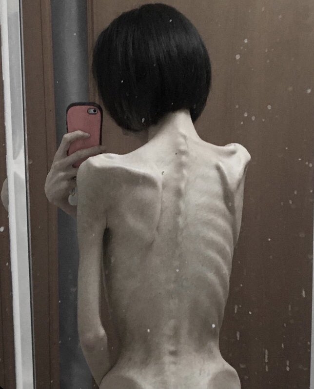 edtwtlilly's tweet photo. Honestly goals #thinspo #bonespo
 #edtwt #anatwt #edtwt #th1nsp0
#handspo #ed #edtw #skinny #thighgap #ed #calories #goalbody #thin #perfectbody #weightloss #anorexia #meanspo #edtwtdiet https://t.co/xbn9NzkpMS
