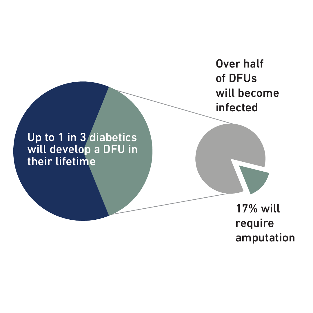 kerecis's tweet photo. Diabetic foot ulcers have been increasing, however a clinical study shows that Kerecis Fish-Skin Graft showed faster healing than SOC, therefore reducing the likelihood of a patient being considered for an amputation. 🩺 

Learn more: https://t.co/bZE6ATPimx #Study https://t.co/txhSe0Xng9