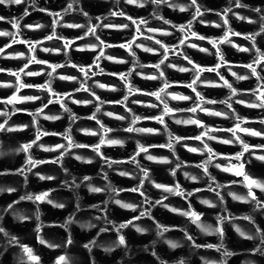 zfm31's tweet photo. Lab fun with the new 980.
Beautiful images of cochlear hair cells by Claire Scott!
@zeiss_micro @CCRB27 https://t.co/l1agZFBFi2