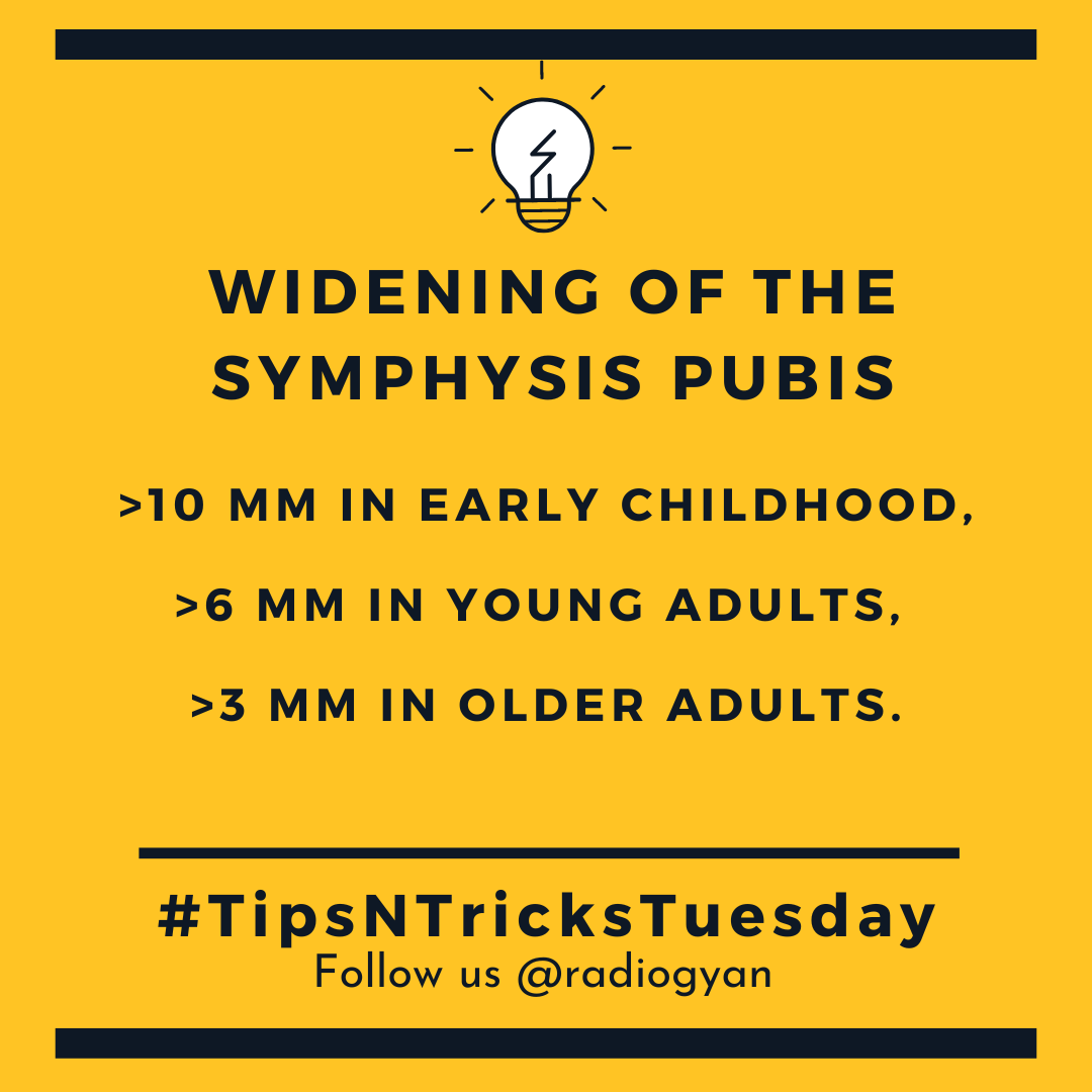 TeamRadioGyan's tweet image. #TipsnTricksTuesday 

Here is a new pearl about widening of symphysis pubis. 

All credits to #TeamGyan member Dr. Disha Lokhandwala.
Follow her on Instagram @dishasradiologyillustrations.

#Pubis #msk #mskrad
#Foamrad #radres #radiogyan    
#radiology #education #internet