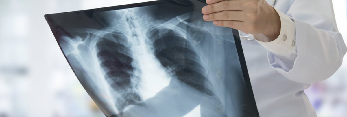 ContentGeneMD's tweet photo. Deep Learning-Aided Automated #Pneumonia Detection and Classification Using CXR Scans

To access the FULL TEXT for FREE, register here:
https://t.co/7DGwcGhIak

#DeepLearning 
#MachineLearning 
#ArtificialIntelligence 
#XRAY https://t.co/LOkBQczUVN
