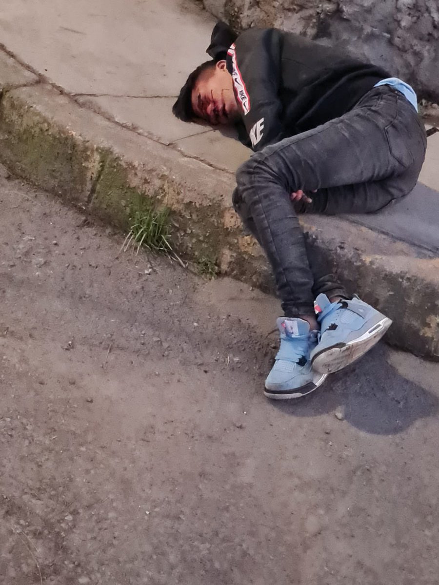 TlalpanVecinos's tweet photo. Nos piden compartir lo siguiente:

Se busca familiares, fue golpeado tiene 15 años de edad, dice vivir en Santa Fe

Estaba en Halacho y Sisal, fue trasladado al hospital Pediátrico de Coyoacán. https://t.co/cThPXNAHzA