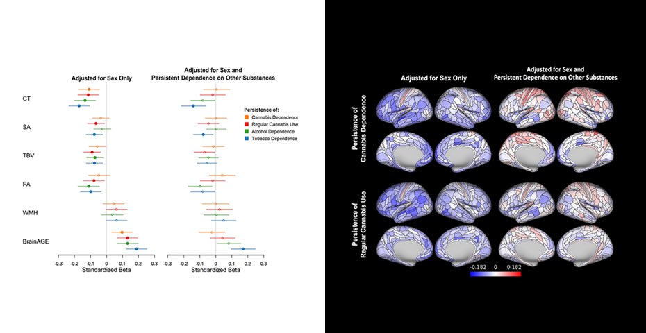 Annchen Knodt (@annchenknodt) on Twitter photo Excited to share our latest publication at <a href="/NeurogenDuke/">HaririLab Duke</a>! We evaluate brain structure in #cannabis users in the Dunedin Study, finding patterns of reduced integrity, but they are explained by concurrent use of #alcohol and #tobacco.
sciencedirect.com/science/articl… Excited to share our latest publication at <a href="/NeurogenDuke/">HaririLab Duke</a>! We evaluate brain structure in #cannabis users in the Dunedin Study, finding patterns of reduced integrity, but they are explained by concurrent use of #alcohol and #tobacco.
sciencedirect.com/science/articl…