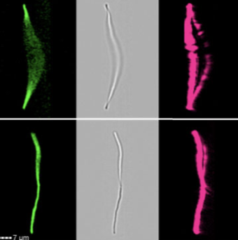 DrAnnPower's tweet photo. B. subtilis: tall, fluorescent & handsome here! Cell images captured by #imagingflowcytometry Check out @FrontCellInfect publication: https://t.co/uvXyMnfbjL @SariqaWagley
#microscopy #luminex #imagestream #bacteria #microbiology #microbes #microbiome #underthemicroscope https://t.co/6saFcOZTCU