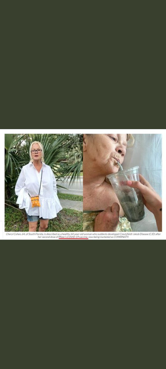 _samedi_'s tweet photo. 🔴 La plus grande société hospitalière américaine a discrètement retiré un rapport d'un cas de maladie cérébrale mortelle après la vaccination par l'ARNm

Elle s'appelait Cheryl Cohen, avait 64 ans et est décédée de la maladie de Creutzfeldt-Jakob 3 mois après sa 2eme💉Pfizer https://t.co/hMDmp3jft8