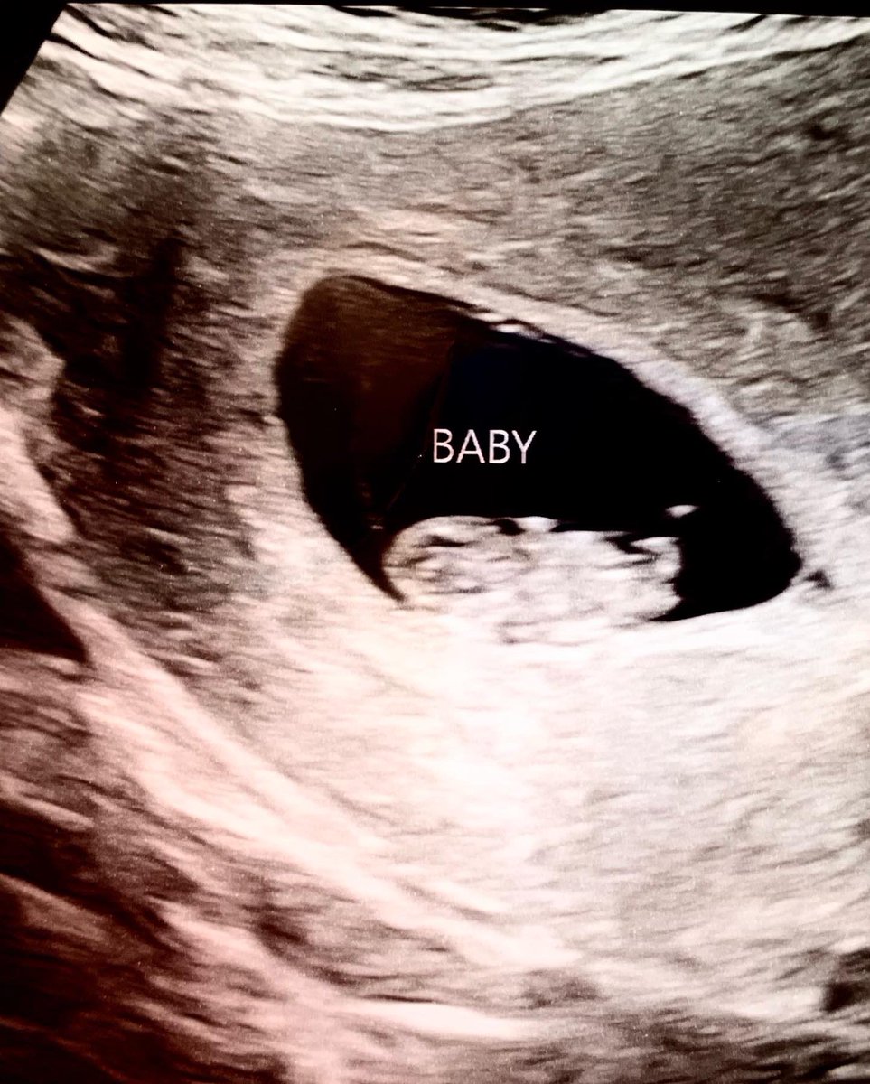 So I’m sure many of you have noticed season 3 delay. We had things come up including this big announcement!! 

It’s time to add a new wilderness explorer to our family adventures! 

Baby DAME #3 coming January 2023!

Don’t worry, we won’t take a 3 year hiatus like last time. 😅