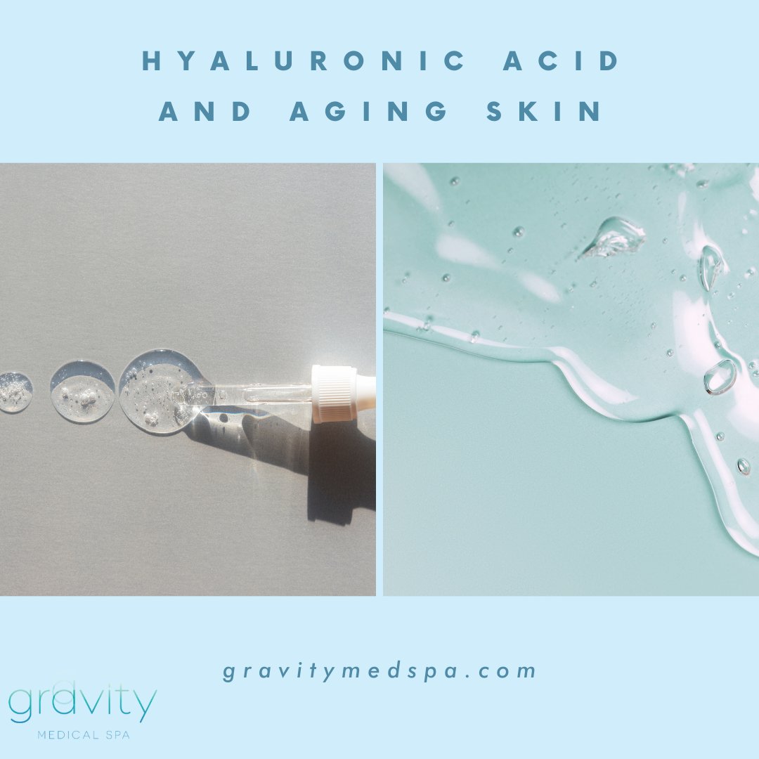 gravitymedspa's tweet photo. HA attracts and binds water to the skin. It keeps the skin looking smooth, youthful and vibrant. Young skin is smooth and elastic and contains large amounts of HA.

🌐https://t.co/X6NdB0c8qg 
.
#Hyaluronic #estheticianblogger #skincareblogger #skincareroutine #skincareinformation https://t.co/Jvg7ly5HW3