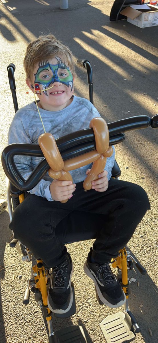 medicguy9414's tweet photo. Fighting neuroblastoma for the second. Almost couldn’t tell #neuroblastoma #neuroblastomawarrior #ChildhoodCancer #kamstrong https://t.co/oOjqUtcHm4