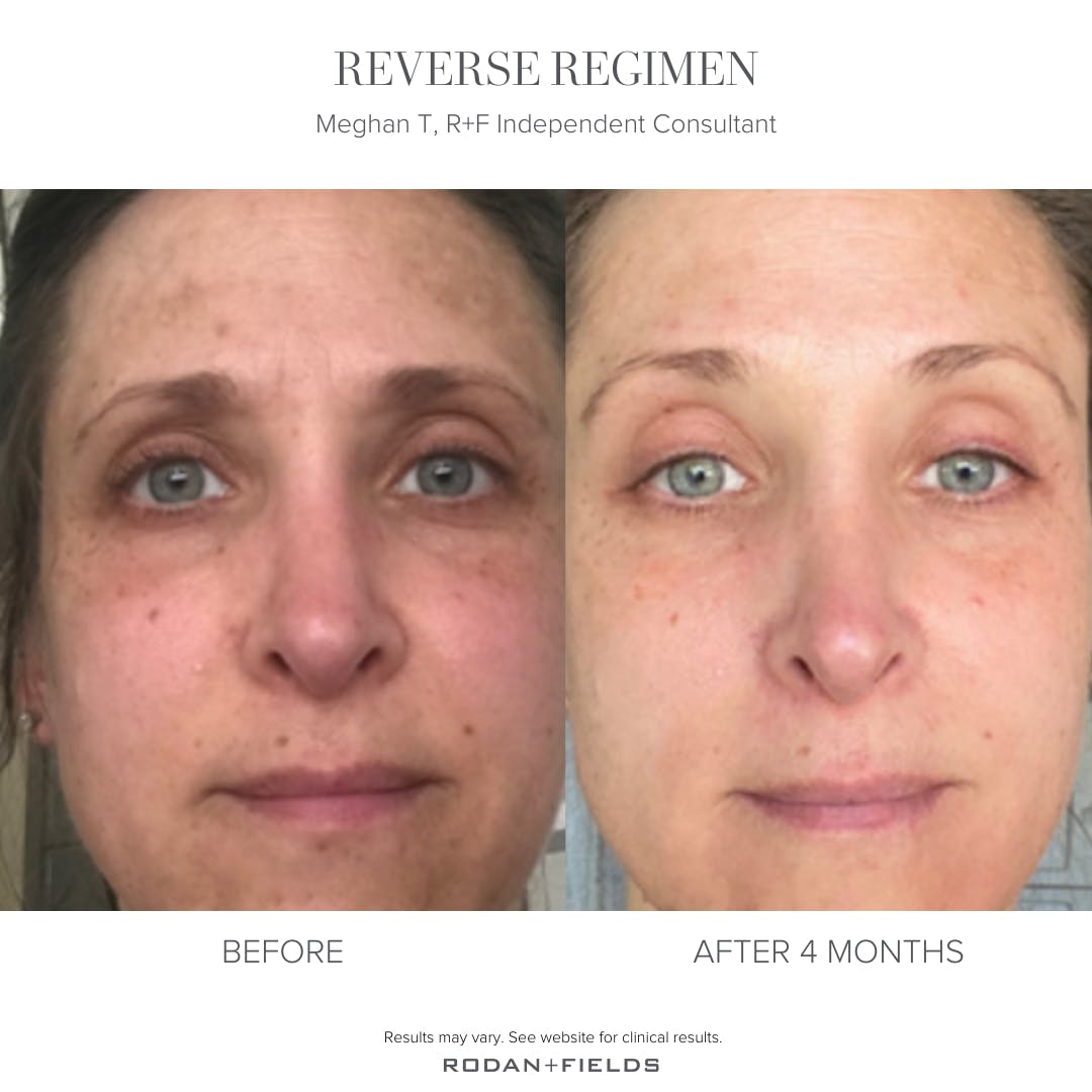 TheWennerCircle's tweet photo. Reverse Skin Brightening Routine
Explore the Reverse skincare collection, designed to visibly improve discoloration, uneven skin tone and fine lines.

Custom Skin Consult
 https://t.co/VHTMIITBq9 https://t.co/nCbOlO72gt