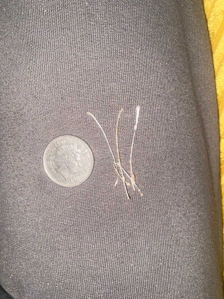naomimorrison_'s tweet photo. @AsdaServiceTeam @asda 
I understand it’s your cheaper range but advertising something as boneless when it’s clearly not is so dangerous. How could you miss those???? Look at the size of the bones. Thank god I noticed the bones before eating.
#asdajustessentials #ASDA https://t.co/xAvhfJ0DF6