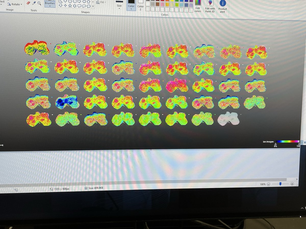 LaurenceFlorens's tweet photo. New Tech! We have officially deployed a new #timsTOF FleX MALDI2 (with a lot of help from Bruker's application scientists). A big thank you to @ScienceStowers scientific leadership for this opportunity to bring imaging mass spec to bear on our collaborators' projects. https://t.co/fT7au2BMQL