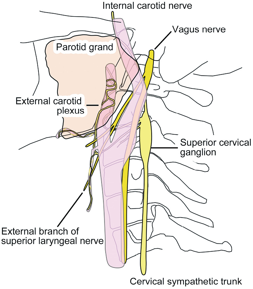 Neurologia medico-chirurgica on Twitter: "NewArrival: First Bite Syndrome  after Carotid Endarterectomy for High Carotid Bifurcation and Extensive  Lesions:Two Case Reports and Literature Review https://t.co/c1sbhsLqzx  #CeaCas #CarotidArteryStenosis ...