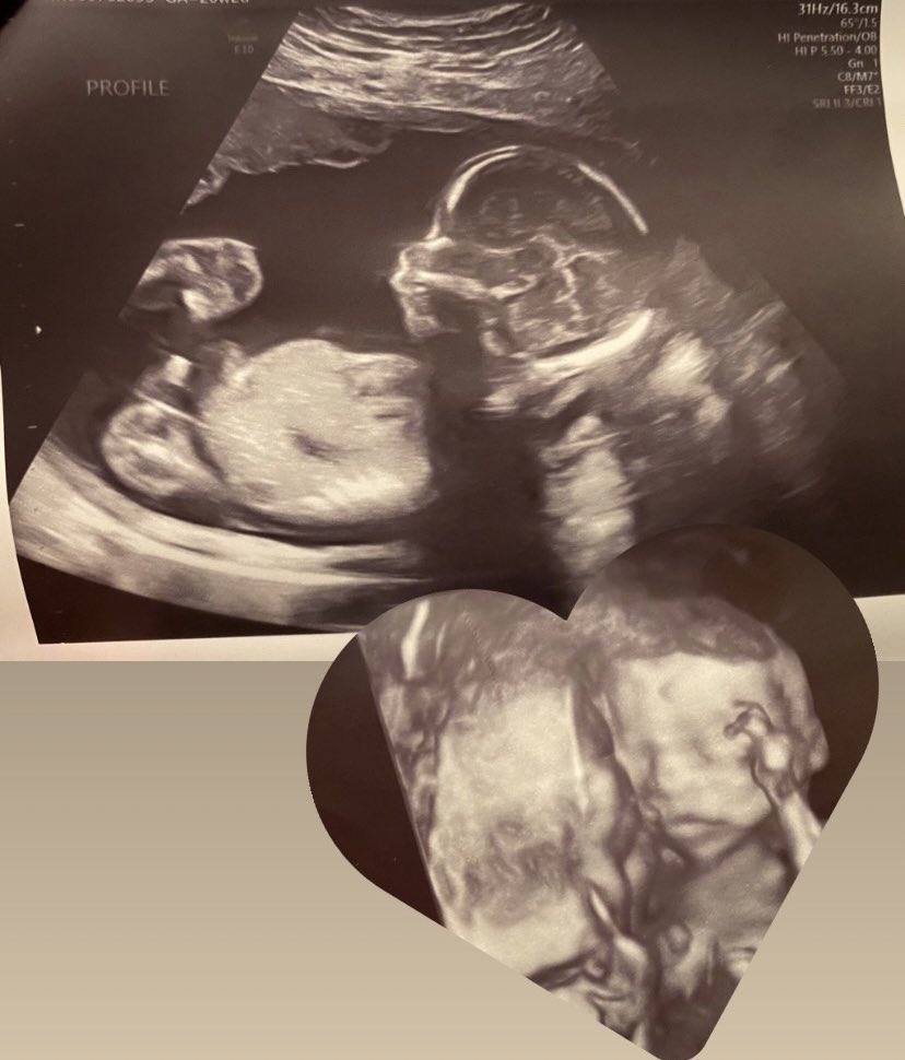 Vicky____13's tweet photo. best part of my day yesterday, seeing our baby boy.💙 i already love him more than he’ll ever know.🥹 hurry up january, we can’t wait to meet him.🤰🏽❤️ @CarranzaBj https://t.co/4TwVa78v0S