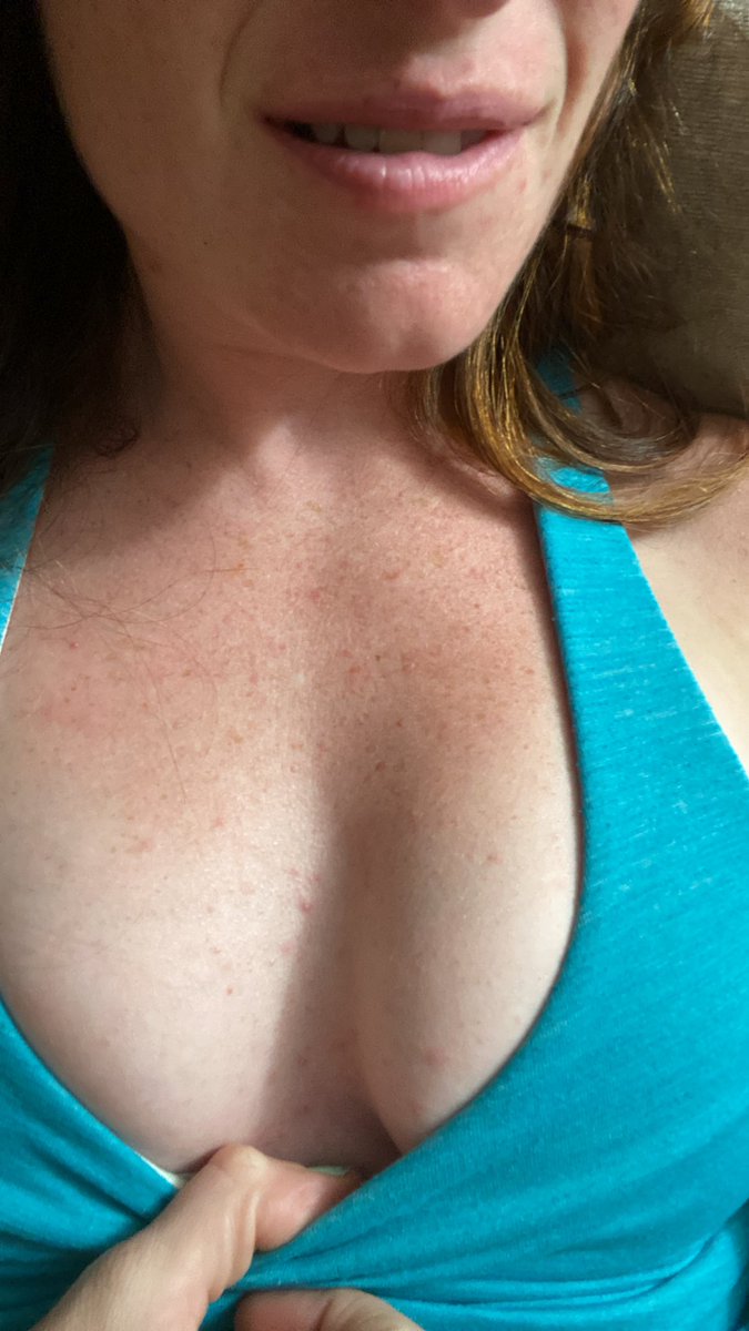 _ginger_gymnast's tweet photo. Really craving you on #touchtuesday … just guessing you’d start here…?

#onlyfansgirl #onlyfans #tuesday https://t.co/CcDObzpY3V