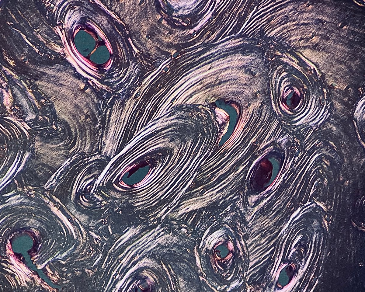 Lamellar bone under polarized light #PathArt #PathTwitter