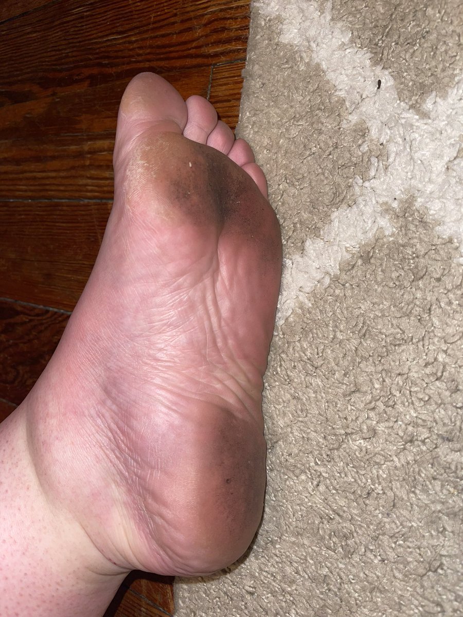 QueenRaspberry2's tweet photo. Up to no good outside today. 
Which little foot piggie is going to clean this up? 🐷 

#Findom #Worship #Cashcow #Dominatrix #HumanATM #Humiliation #FemDom #Paypig #BBWFemDom #NSFW #NSFWTWT #finsub #plussize #bbw #chubby https://t.co/6ie4qWTHiq