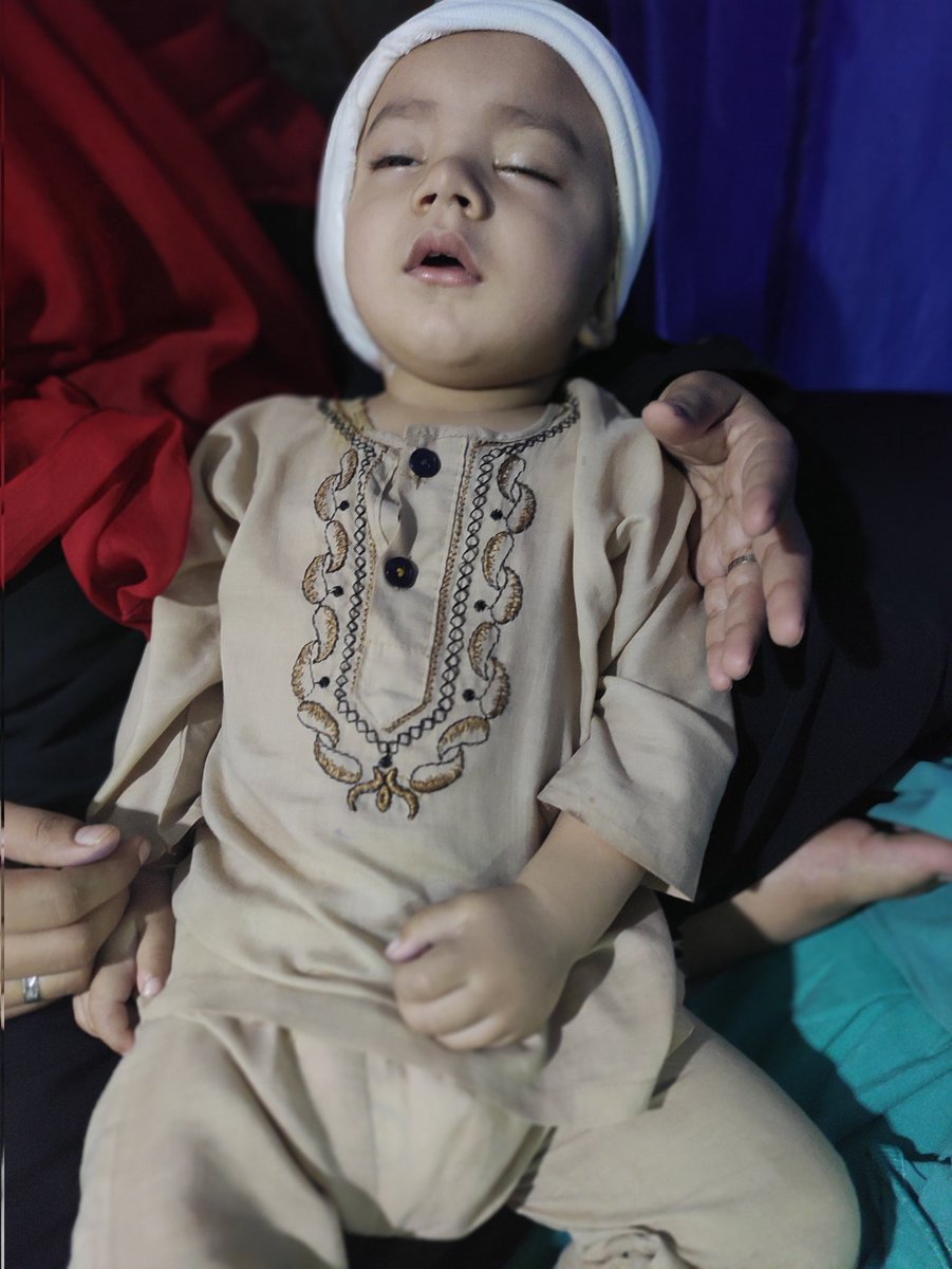 iamhamid18's tweet photo. Alhamdulillah 💞, ALLAH k fazlo karam se kheroafiat k sath Cochlear Implant Surgery hogea ha According to Dr, Alhamdulillah Operation bht acha hua ha, ALLAH kamyab kre aur sehat atta kre. Ameen https://t.co/z1volEw8dn