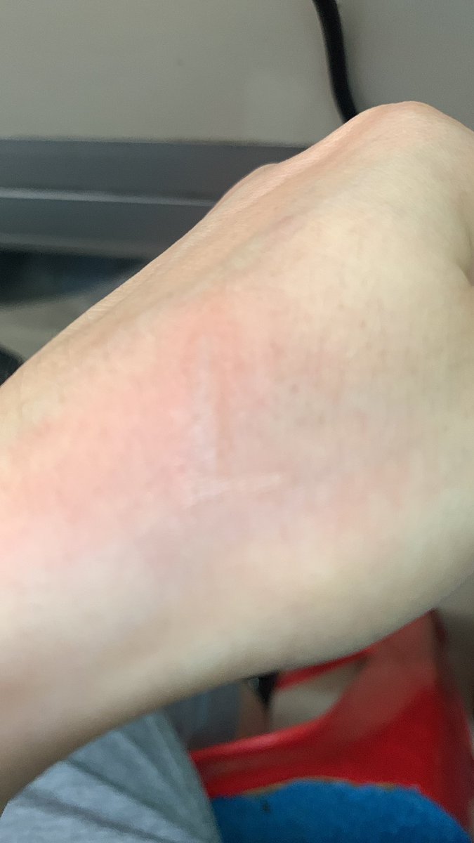 _kyarinchan's tweet photo. Nambah tato hasil dari goreng kerupuk https://t.co/ecc6ggDw99