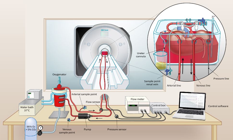 #MagneticResonanceImaging during warm #ExVivo #Kidney perfusion | #FreeAccess👇
bit.ly/3pDElzW
@Univgroningen🇳🇱| @AarhusUni🇩🇰| @Chris_laustsen #MRI #RenalPhysiology