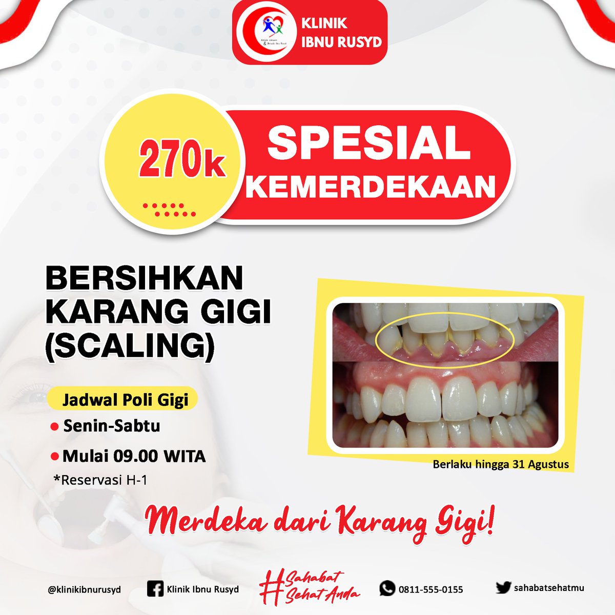 ibnurusydtoday's tweet photo. Tumpas bau mulu oke 👌

#scaling https://t.co/ceGPze7ZDo