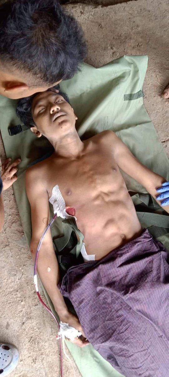 မင်းကိုဒီလောက်ပစ်ခတ်နေတဲ့ကြားက ရအောင်ကယ်ထုတ်ခဲ့ကြတယ်။
မင်းကိုငါတို့အဆုံးထိ မျော်လင့်ခဲ့ကြသေးတာ DeDe ရ အခုတော့ကွာ...
မင်းကွာ...

ရဲဘော် DeDe သြဂုတ် 23 ရက် သုံးထပ်ကွေ့တိုက်ပွဲတွင် CobraColumn အတွက်၊ပြည်သူ့အတွက် မြင့်မြတ်စွာ အသက်ပေးလှူသွားခဲ့သည်။